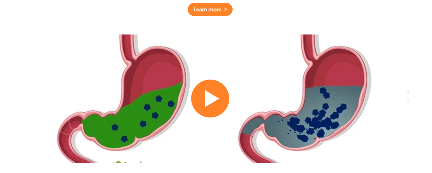 Carolean™: New Synergistic complex for Appetite control