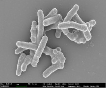 Bifidobacterium bifidum BGN4