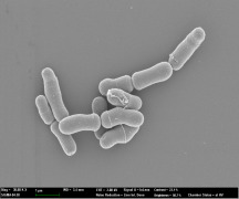 Bifidobacterium lactis AD011