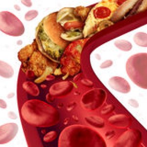 cholesterol-blocked-artery-medical-concept-human-blood-vessel-clogged-unhealthy-food-as-hamburgers-fried-39105490