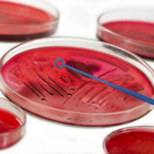 inoculation-microbiology-petri-dish-46654367